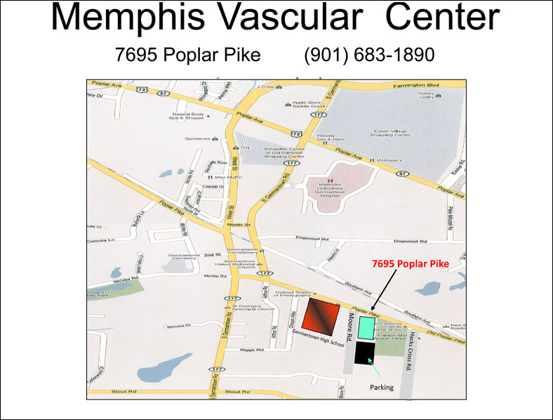 varicose vein doctor memphis