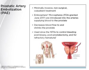 pae artery prostate embolization catheter