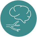 carotid artery disease and stroke - memphis vascular center