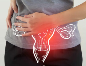 Female Pelvic Pain