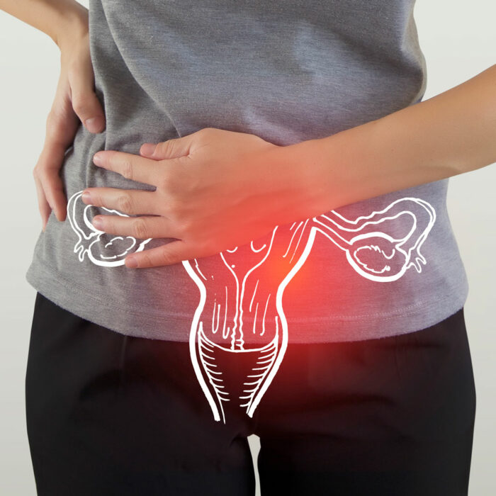 Female Pelvic Pain