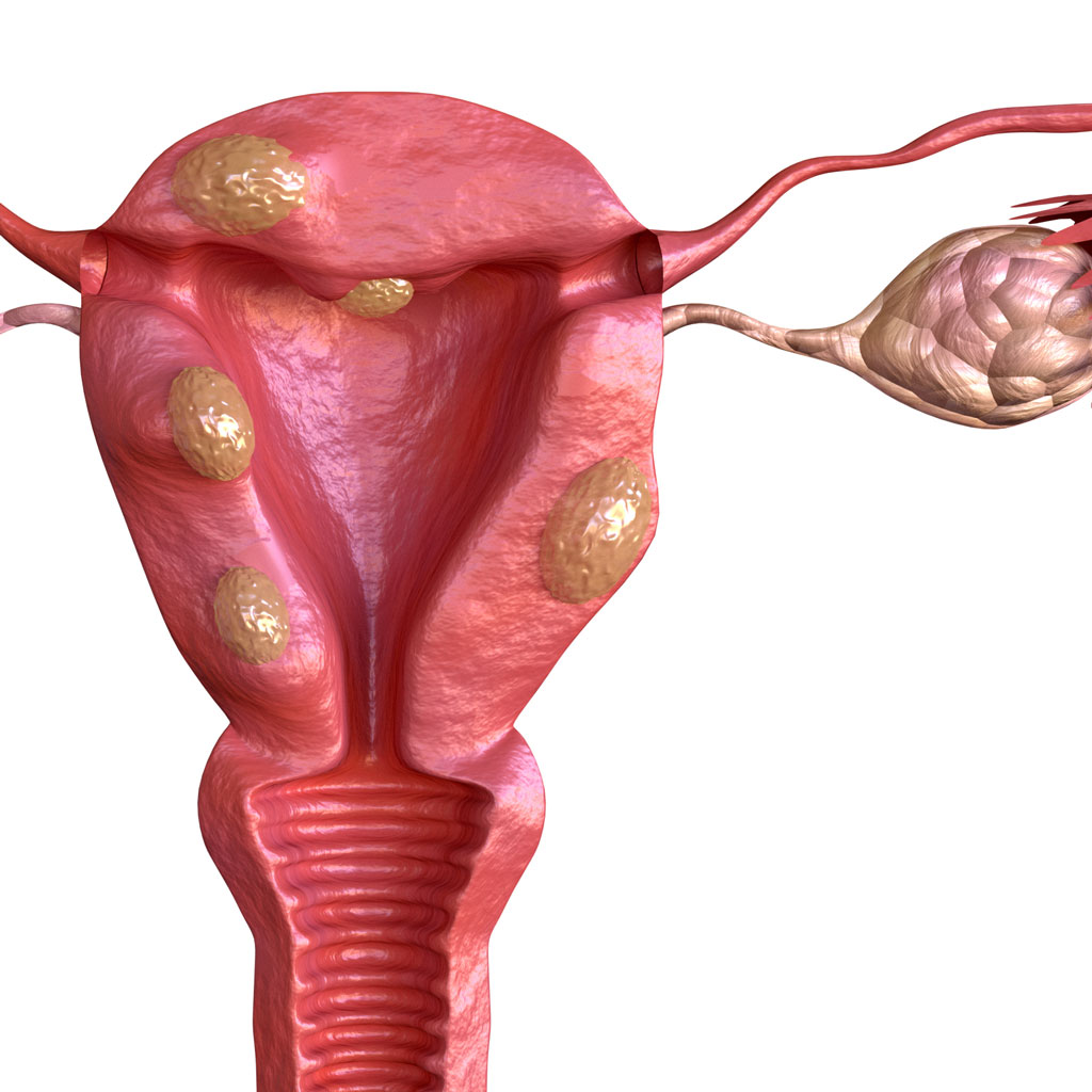 What to Expect During and After UFE Render