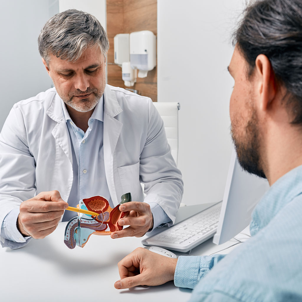 Mildly Enlarged Prostate Model